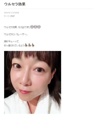 堀ちえみ51歳、ファンも驚く「美への努力」　韓国で美容注射にレーザー治療も...（J-CASTニュース）