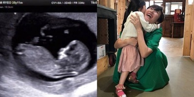 (朝鮮日報日本語版) キム・ミリョが第2子妊娠、エコー写真公開（朝鮮日報日本語版）